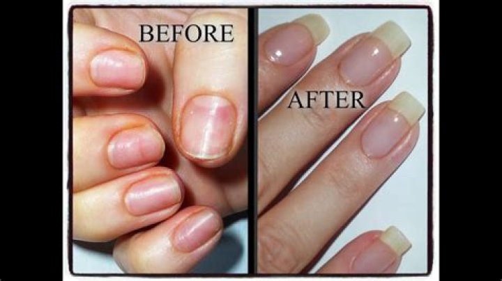 What to do after getting acrylics?