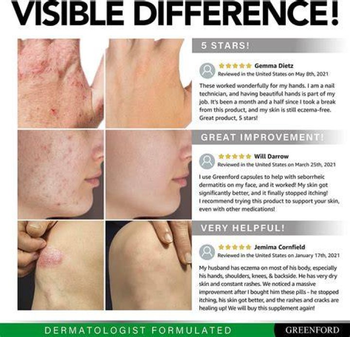 What vitamins cure eczema?
