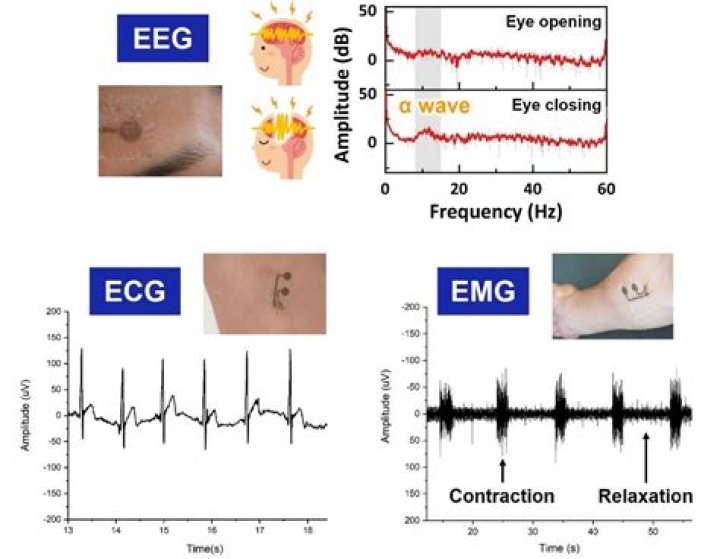 Whats the difference between EMG and EEG?