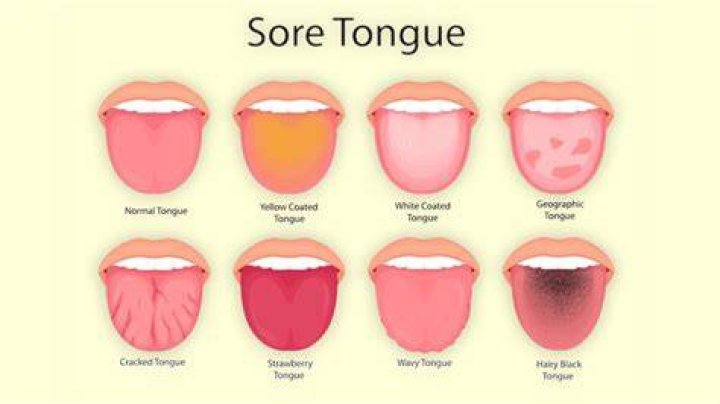 When I brush my tongue its yellow?