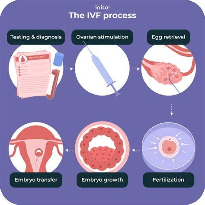 When should an IVF baby be delivered?