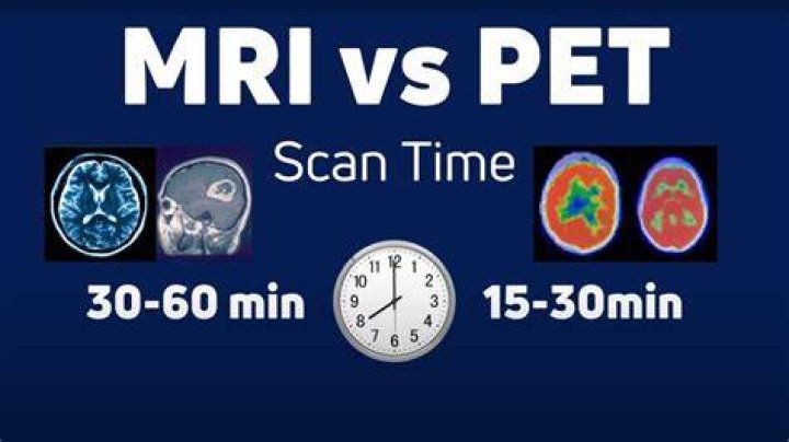 Which is more expensive a CAT scan or MRI?