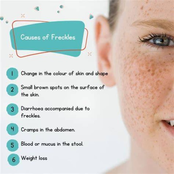 Why did I have freckles as a kid but not now?