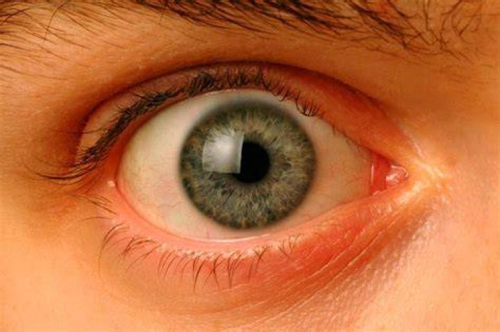 Why do eyes come in pairs?