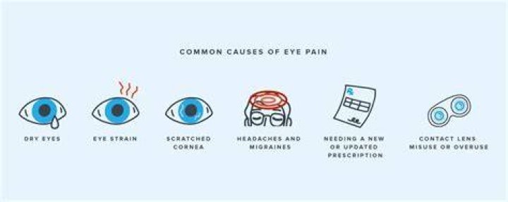 Why do I have SAD eyes?