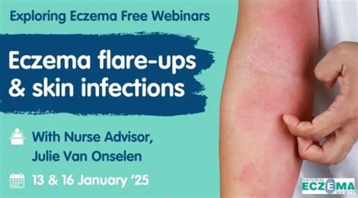 Why does my eczema flare up after a shower?