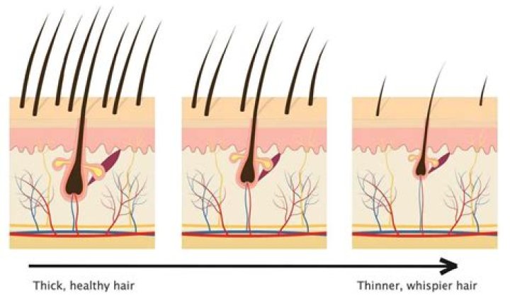 Why is my hair getting lighter and thinner?