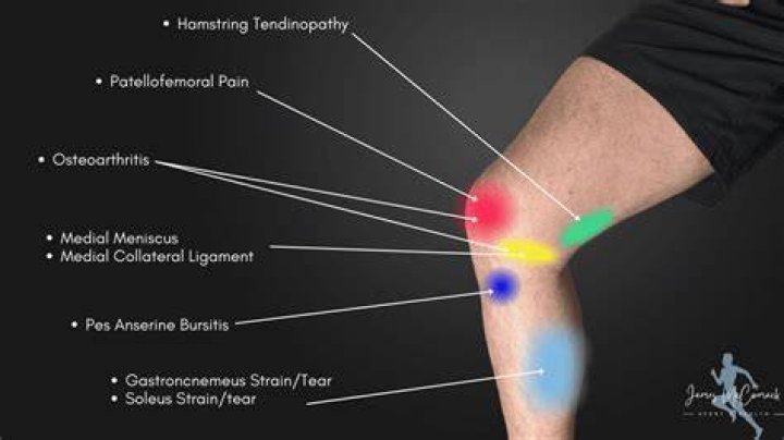 Why is my left leg numb below the knee?