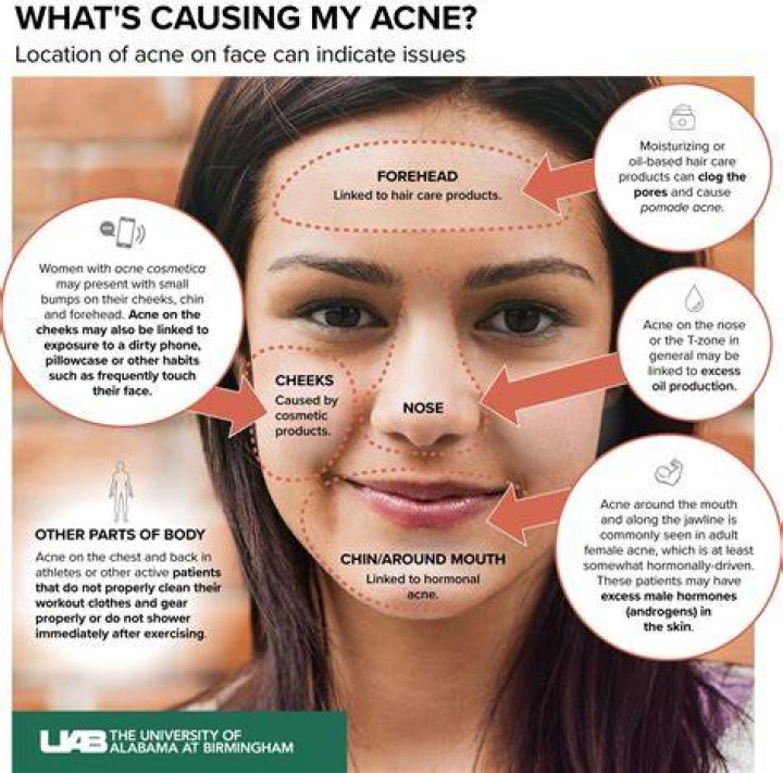 Why is my skin breaking out?