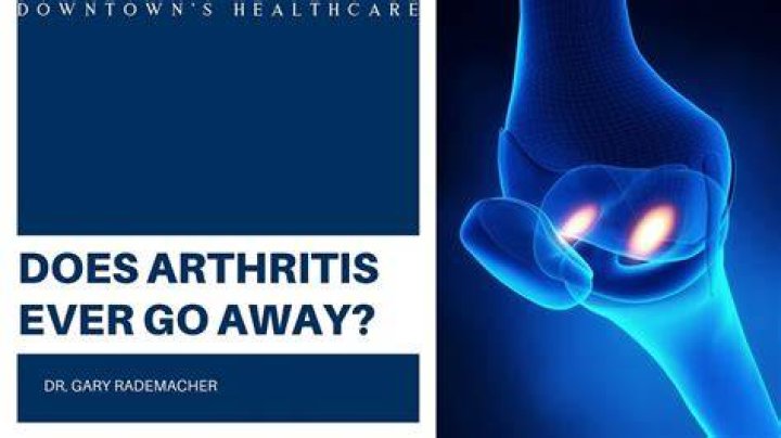 Will arthritis ever go away?